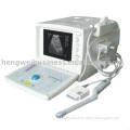 Digital B-ultrasound diagnostic apparatus with convex array